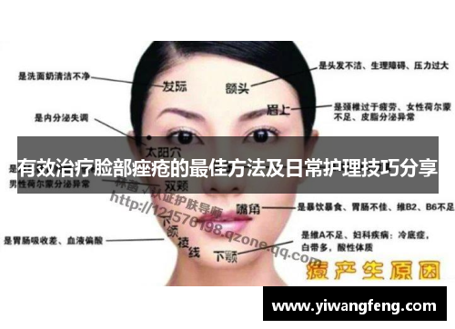 有效治疗脸部痤疮的最佳方法及日常护理技巧分享